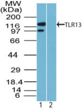 Western blot of TLR13 in rat corpus (tissue is from male rat reproductive tract) lysate in the 1) absence and 2) presence of immunizing peptide using LS-C148184 at1 ug/ml. Goat anti-rabbit Ig HRP secondary antibody, and PicoTect ECL substrate solution, were used for this test.