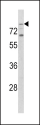 Western blot of hTLR2-C226 in K562 cell line lysates (35 ug/lane). TLR2 (arrow) was detected using the purified antibody.