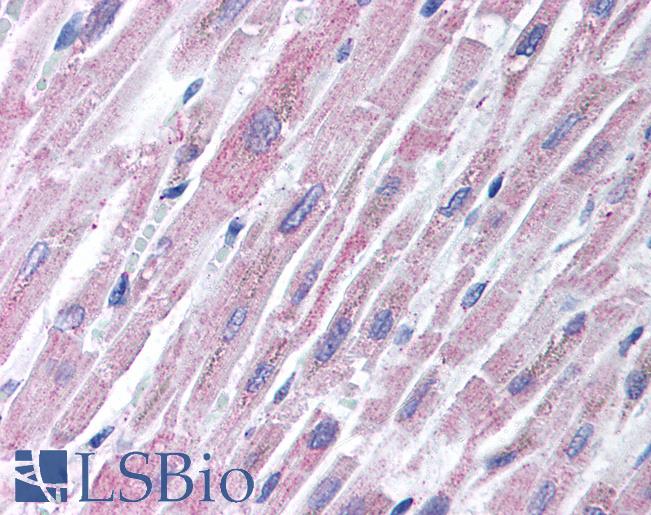 Anti-TLR2 antibody IHC of human heart. Immunohistochemistry of formalin-fixed, paraffin-embedded tissue after heat-induced antigen retrieval. Antibody LS-B1417 concentration 2 ug/ml.