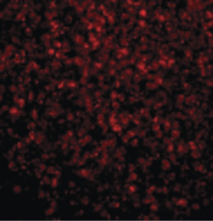 Immunofluorescence of TLR2 in Human Spleen cells with TLR2 antibody at 10 ug/ml.
