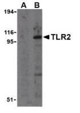 Western blot of TLR2 in A20 cell lysates with TLR2 antibody at 1 ug/ml in the presence (A) and absence (B) of its blocking peptide.