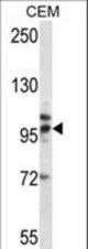 TLR2 Antibody western blot of CEM cell line lysates (35 ug/lane). The TLR2 antibody detected the TLR2 protein (arrow).