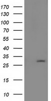 HEK293T cells were transfected with the pCMV6-ENTRY control (Left lane) or pCMV6-ENTRY PYCRL (Right lane) cDNA for 48 hrs and lysed. Equivalent amounts of cell lysates (5 ug per lane) were separated by SDS-PAGE and immunoblotted with anti-PYCRL.