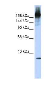 PRPF8 antibody LS-C110549 Western blot of Jurkat lysate.