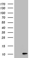 HEK293T cells were transfected with the pCMV6-ENTRY control (Left lane) or pCMV6-ENTRY PYDC1 (Right lane) cDNA for 48 hrs and lysed. Equivalent amounts of cell lysates (5 ug per lane) were separated by SDS-PAGE and immunoblotted with anti-PYDC1.