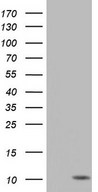 HEK293T cells were transfected with the pCMV6-ENTRY control (Left lane) or pCMV6-ENTRY PYDC1 (Right lane) cDNA for 48 hrs and lysed. Equivalent amounts of cell lysates (5 ug per lane) were separated by SDS-PAGE and immunoblotted with anti-PYDC1.
