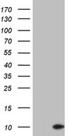 HEK293T cells were transfected with the pCMV6-ENTRY control (Left lane) or pCMV6-ENTRY PYDC1 (Right lane) cDNA for 48 hrs and lysed. Equivalent amounts of cell lysates (5 ug per lane) were separated by SDS-PAGE and immunoblotted with anti-PYDC1.