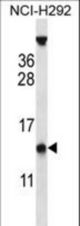 PYDC1 Antibody western blot of NCI-H292 cell line lysates (35 ug/lane). The PYDC1 antibody detected the PYDC1 protein (arrow).