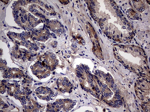 IHC of paraffin-embedded Human prostate tissue using anti-PYDC1 mouse monoclonal antibody. (Heat-induced epitope retrieval by 1 mM EDTA in 10mM Tris, pH8.5, 120°C for 3min).