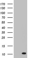 HEK293T cells were transfected with the pCMV6-ENTRY control (Left lane) or pCMV6-ENTRY PYDC1 (Right lane) cDNA for 48 hrs and lysed. Equivalent amounts of cell lysates (5 ug per lane) were separated by SDS-PAGE and immunoblotted with anti-PYDC1.