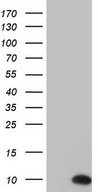 HEK293T cells were transfected with the pCMV6-ENTRY control (Left lane) or pCMV6-ENTRY PYDC1 (Right lane) cDNA for 48 hrs and lysed. Equivalent amounts of cell lysates (5 ug per lane) were separated by SDS-PAGE and immunoblotted with anti-PYDC1.