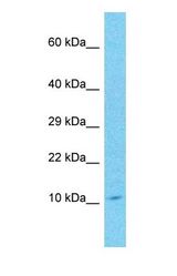 Western blot of PYDC1 Antibody with human Lymph Node Tumor lysate.