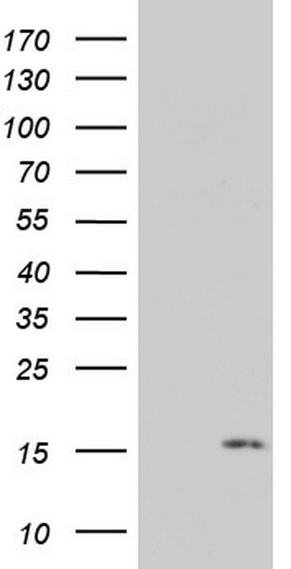 HEK293T cells were transfected with the pCMV6-ENTRY control (Left lane) or pCMV6-ENTRY PYDC1 (Right lane) cDNA for 48 hrs and lysed. Equivalent amounts of cell lysates (5 ug per lane) were separated by SDS-PAGE and immunoblotted with anti-PYDC1.