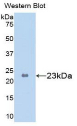 Western blot of recombinant PYGL.