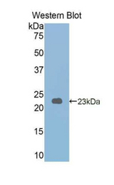 Western blot of recombinant PYGL.