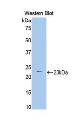 Western blot of recombinant PYGL.