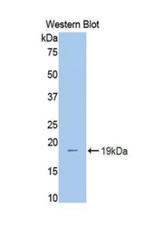 Western blot of recombinant PYGL.