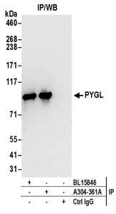 Detection of Human PYGL by Western Blot of Immunoprecipitates. Samples: Whole cell lysate (0.5 or 1.0 mg per IP reaction; 20% of IP loaded) prepared using RIPA buffer from 293T cells. Antibodies: Affinity purified rabbit anti-PYGL antibody used for IP at 6 ug per reaction. PYGL was also immunoprecipitated by rabbit anti-PYGL antibody BL15846. For blotting immunoprecipitated PYGL, was used at 1 ug/ml. Detection: Chemiluminescence with an exposure time of 30 seconds.