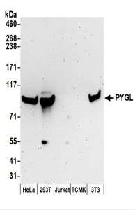 Detection of Human and Mouse PYGL by Western Blot. Samples: Whole cell lysate (50 ug) prepared using NETN buffer from HeLa, 293T, Jurkat, mouse TCMK-1, and mouse NIH3T3 cells. Antibodies: Affinity purified rabbit anti-PYGL antibody used for WB at 0.1 ug/ml. Detection: Chemiluminescence with an exposure time of 3 minutes.