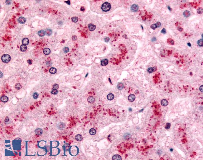Anti-PYGL antibody LS-A2283 IHC of human liver. Immunohistochemistry of formalin-fixed, paraffin-embedded tissue after heat-induced antigen retrieval.