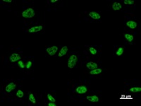 Immunostaining analysis in HeLa cells. HeLa cells were fixed with 4% paraformaldehyde and permeabilized with 0.1% Triton X-100 in PBS. The cells were immunostained with anti-PRPF8 mAb.