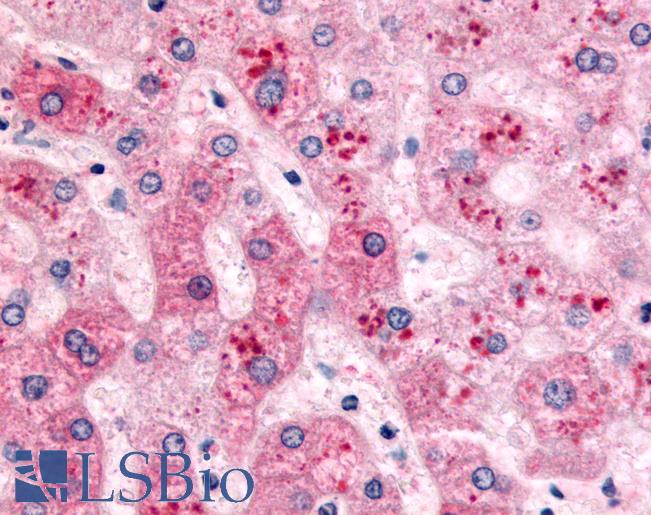Anti-PYGL antibody LS-A1488 IHC of human liver. Immunohistochemistry of formalin-fixed, paraffin-embedded tissue after heat-induced antigen retrieval.