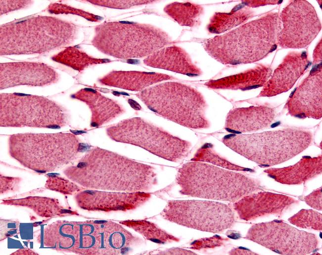 Anti-PYGM / Phosphorylase b antibody LS-A2284 IHC of human skeletal muscle. Immunohistochemistry of formalin-fixed, paraffin-embedded tissue after heat-induced antigen retrieval.