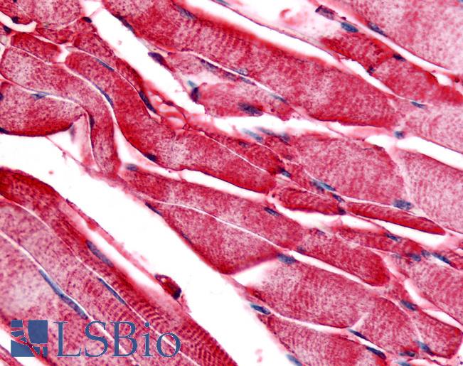 Anti-PYGM / Phosphorylase b antibody LS-A1487 IHC of human skeletal muscle. Immunohistochemistry of formalin-fixed, paraffin-embedded tissue after heat-induced antigen retrieval.