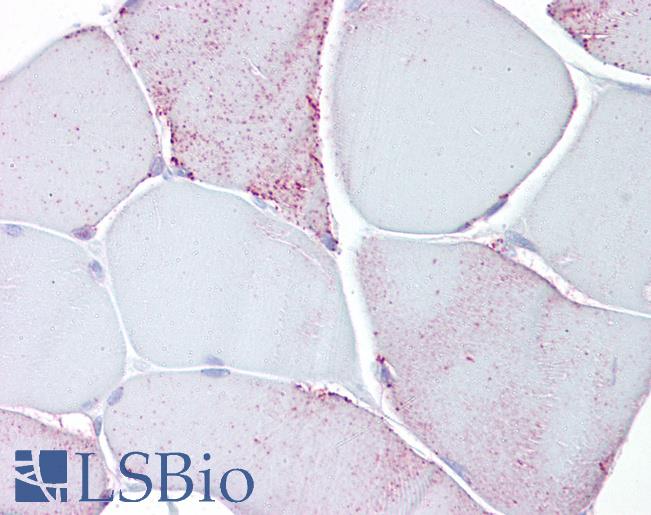 Anti-PYGM / Phosphorylase b antibody IHC of human skeletal muscle. Immunohistochemistry of formalin-fixed, paraffin-embedded tissue after heat-induced antigen retrieval. Antibody LS-B6905 concentration 10 ug/ml.