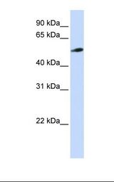 Jurkat cell lysate. Antibody concentration: 1.0 ug/ml. Gel concentration: 12%.
