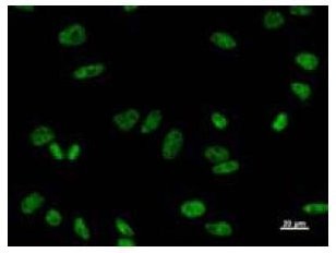 Immunofluorescent staining using PRPF8 antibody. Immunostaining analysis in HeLa cells. HeLa cells were fixed with 4% paraformaldehyde and permeabilized with 0.01% Triton-X100 in PBS. The cells were immunostained with anti-PRPF8 antibody.