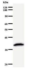 Western blot of immunized recombinant protein using PRPF8 antibody.