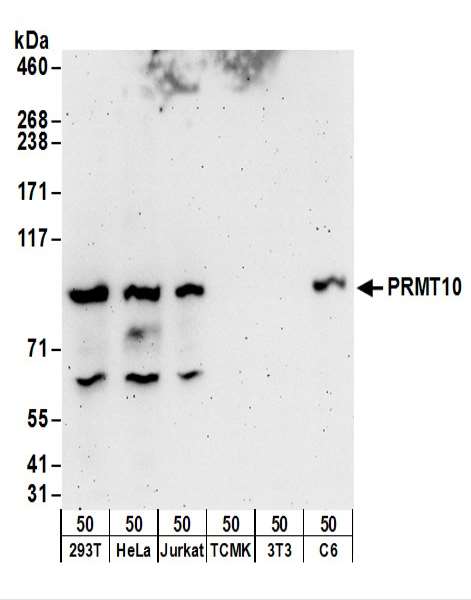 Detection of Human and Rat PRMT10 by Western Blot. Samples: Whole cell lysate (50 ug) from 293T, HeLa, Jurkat, mouse TCMK-1, mouse NIH3T3, and rat C6 cells. Antibodies: Affinity purified rabbit anti-PRMT10 antibody used for WB at 0.4 ug/ml. Detection: Chemiluminescence with an exposure time of 3 minutes.
