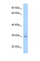 Paqr4 antibody LS-C146270 Western blot of Rat Lung lysate. Antibody concentration 1 ug/ml.