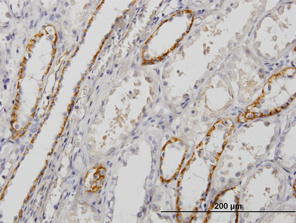 Immunoperoxidase of monoclonal antibody to PALM on formalin-fixed paraffin-embedded human kidney. [antibody concentration 1.5 ug/ml]
