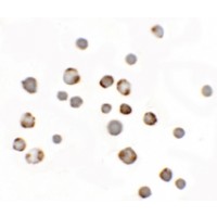 Immunocytochemistry of Paralemmin 3 in MCF7 cells with Paralemmin 3 antibody at 5 µg/mL.