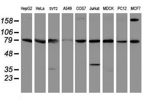 Western blot of extracts (35ug) from 9 different cell lines by using anti-SPG7 monoclonal antibody.