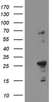 Negative control E. coli lysate (Left lane) or E. coli lysate containing recombinant protein fragment for human SPG7(NP_003110) gene (amino acids 300-573) (Right lane). Equivalent amounts (5 ug per lane) were separated by SDS-PAGE and then immunoblotted with anti-SPG7. .