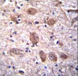 SPG7 Antibody immunohistochemistry of formalin-fixed and paraffin-embedded human brain tissue followed by peroxidase-conjugated secondary antibody and DAB staining.