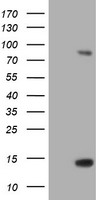 HEK293T cells were transfected with the pCMV6-ENTRY control (Left lane) or pCMV6-ENTRY SPG7 (Right lane) cDNA for 48 hrs and lysed. Equivalent amounts of cell lysates (5 ug per lane) were separated by SDS-PAGE and immunoblotted with anti-SPG7.