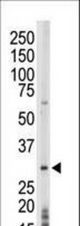 The anti-PRPK antibody is used in Western blot to detect PRPK in mouse thymus tissue lysate.
