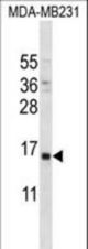 PTH Antibody western blot of MDA-MB231 cell line lysates (35 ug/lane). The PTH antibody detected the PTH protein (arrow).