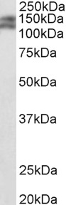 Pard3b antibody (0.5 ug/ml) staining of Mouse fetal Kidney lysate (35 ug protein in RIPA buffer). Primary incubation was 1 hour. Detected by chemiluminescence.