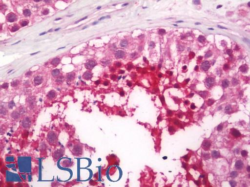 Human Testis: Formalin-Fixed, Paraffin-Embedded (FFPE)
