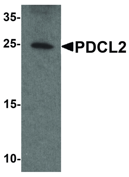 Western blot analysis of PDCL2 in rat liver tissue lysate with PDCL2 antibody at 1 ug/ml.