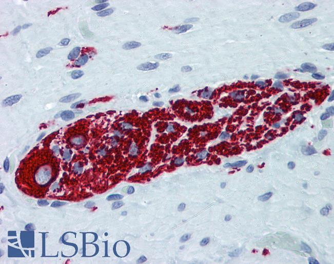 Anti-PRPH / Peripherin antibody IHC of human small intestine, myenteric plexus. Immunohistochemistry of formalin-fixed, paraffin-embedded tissue after heat-induced antigen retrieval. Antibody LS-B6138 concentration 5 ug/ml.
