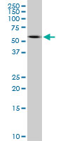 Antibody LS-B6138. Western blot of PRPH expression in IMR-32.