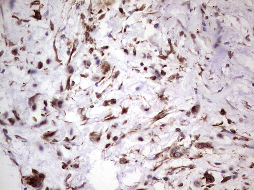 IHC of paraffin-embedded Carcinoma of Human pancreas tissue using anti-PRPH mouse monoclonal antibody. (Heat-induced epitope retrieval by 1 mM EDTA in 10mM Tris, pH8.5, 120°C for 3min).