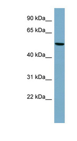 PRPH / Peripherin antibody LS-C107809 Western blot of Fetal Heart lysate.