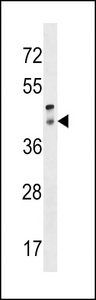 RRH Antibody western blot of human placenta tissue lysates (35 ug/lane). The RRH antibody detected the RRH protein (arrow).